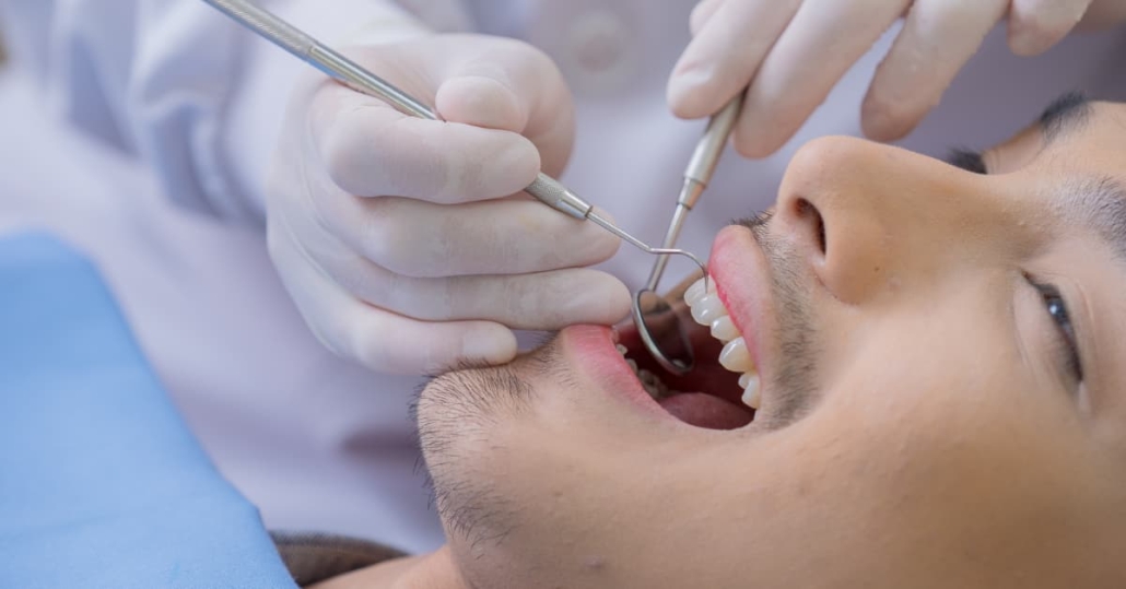 All-on-4 vs All-on-6 dental implants