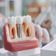Can Anyone Get Dental Implants? Understanding Your Candidacy and Options