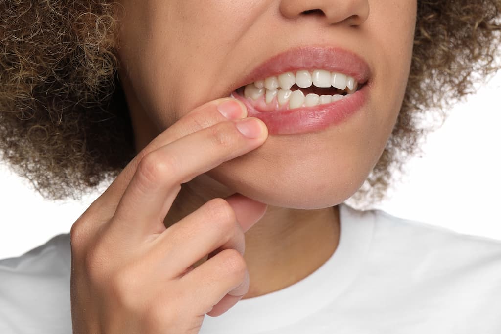 Signs of Gum Disease: Early Warning Symptoms You Shouldn't Ignore